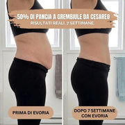 Culotte Post-Parto — Compressione a 360° - Evoria Studio