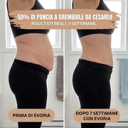 Slip Post Parto — Compressione 360°